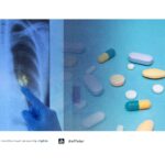 Gelombang Baru R&D TBC di Indonesia: Industri Harus Waspada, Paten Obat Akan Memanas! - AFFA IPR